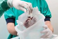 Изменения в закон о трансплантации позволят не заблокировать проведение операций - Минздрав
