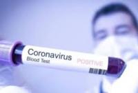 Беларусь опередила Украину по количеству зараженных коронавирусом