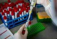 В Днепропетровской области обнаружили шесть новых случаев коронавируса