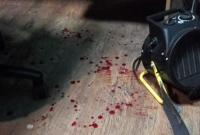 "Напали сзади": в Черкассах чиновник мэрии с помощником избил журналиста
